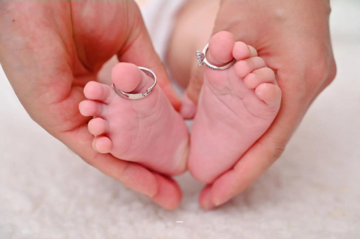 朔州孕妇怎样预防妊娠纹